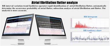 Holter Monitoring Analysis Systems